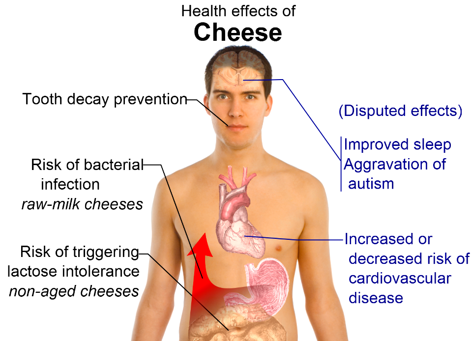 Health effects of cheese