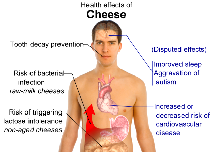 Health effects of cheese