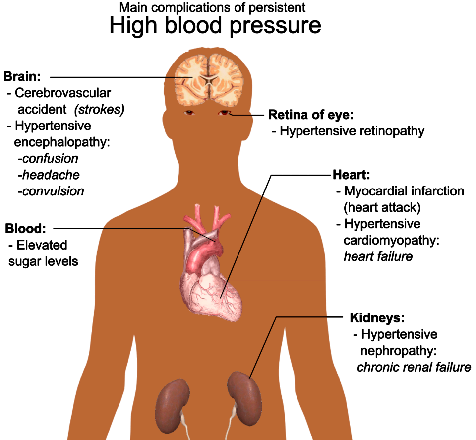 Main complications of persistent high blood pressure