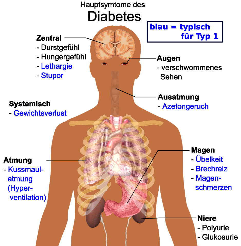 Main symptoms of diabetes-de