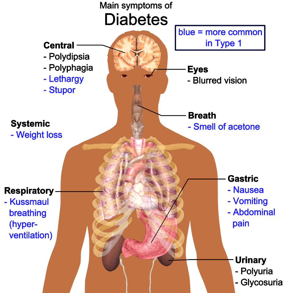 Main symptoms of diabetes