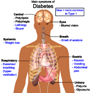 Main symptoms of diabetes photo