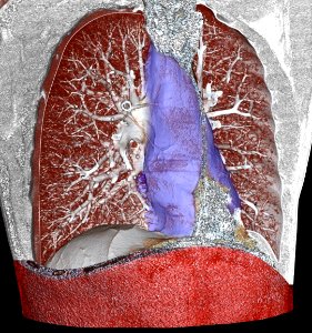 Mediastinum