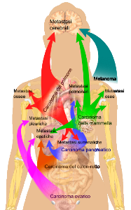 Metastasis sites for common cancers-IT Inkscape