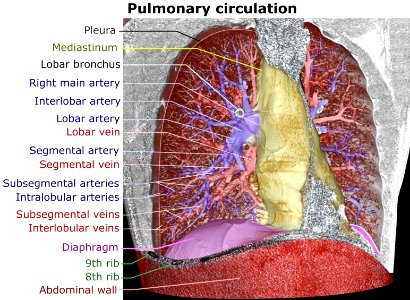 3D CT of thorax, annotated