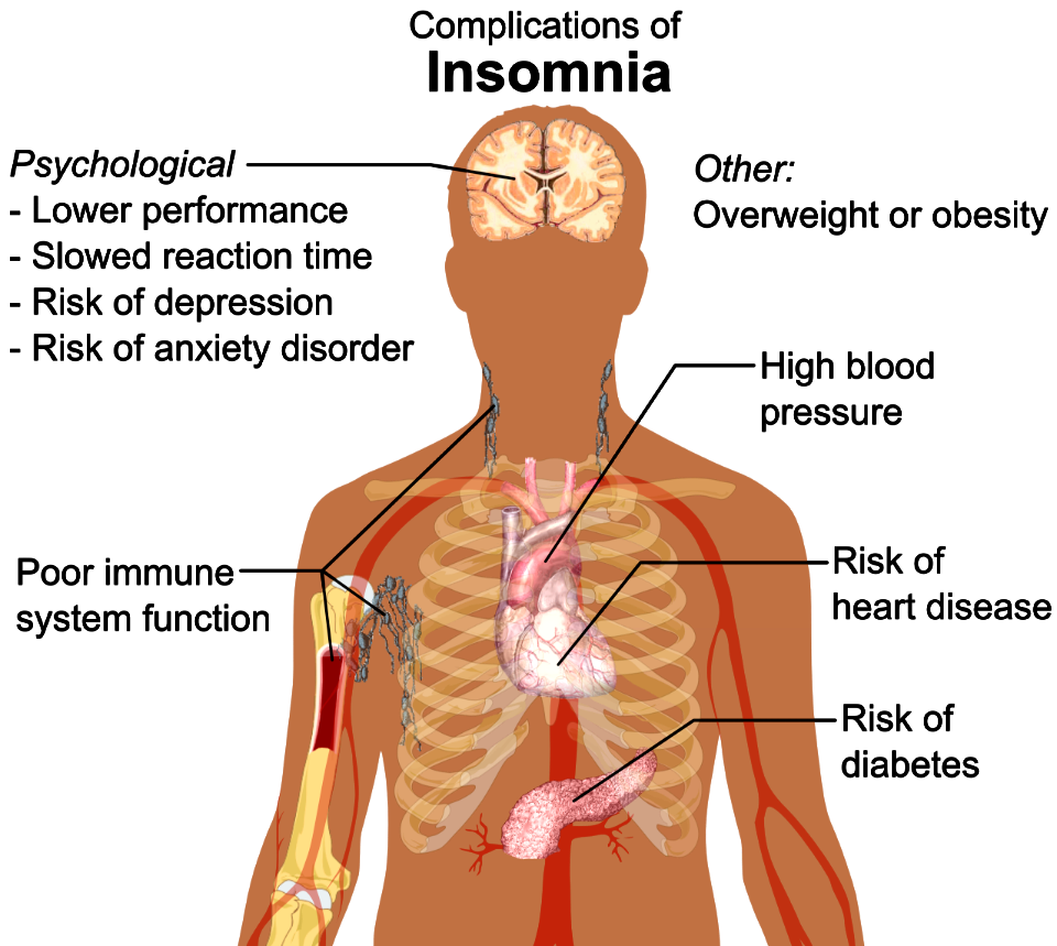Complications of insomnia