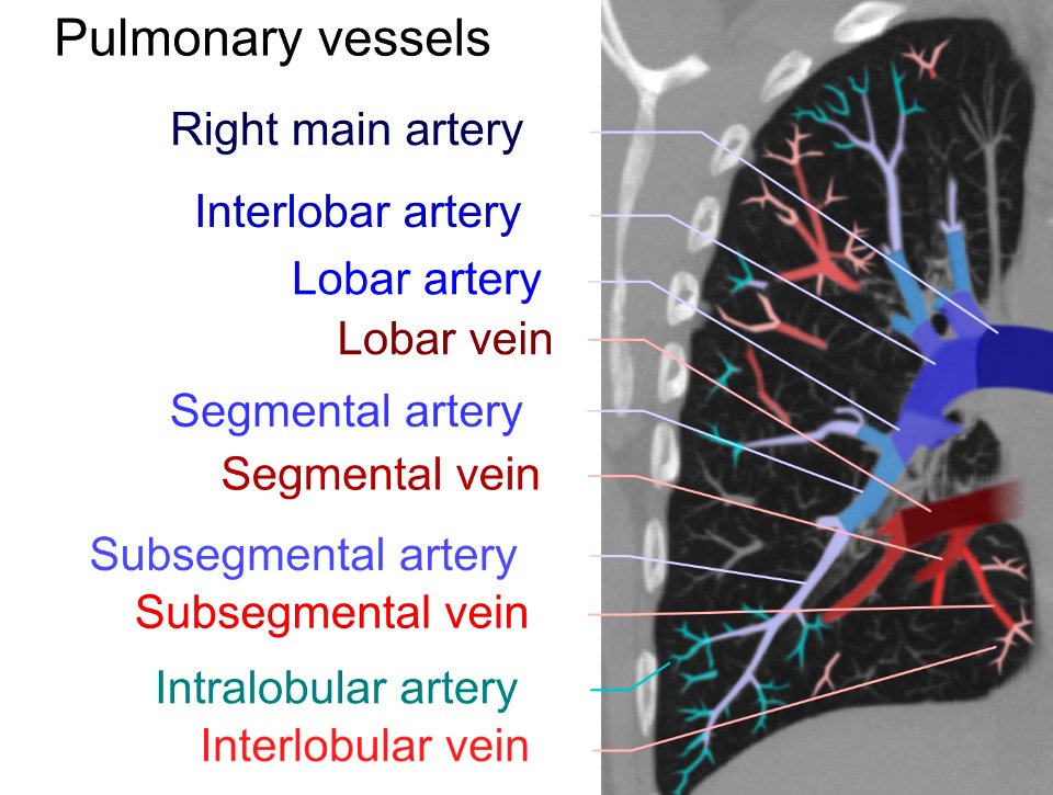 Computed tomograph of pulmonary vessels