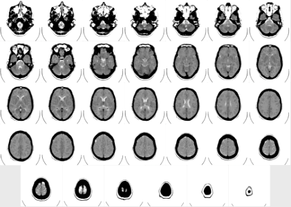 Computed tomography of human brain - large, inverted