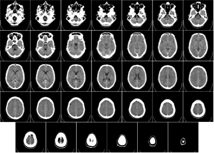 Computed tomography of human brain - large