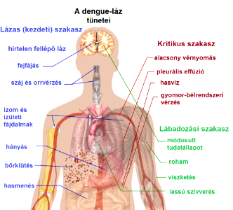 Dengue-láz tünetei