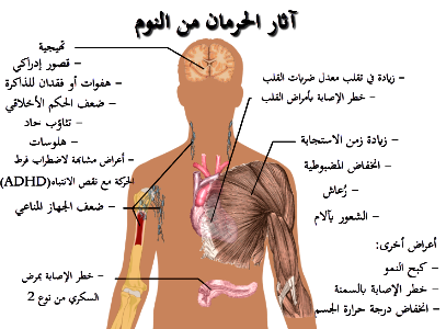 Effects of sleep deprivation-ar
