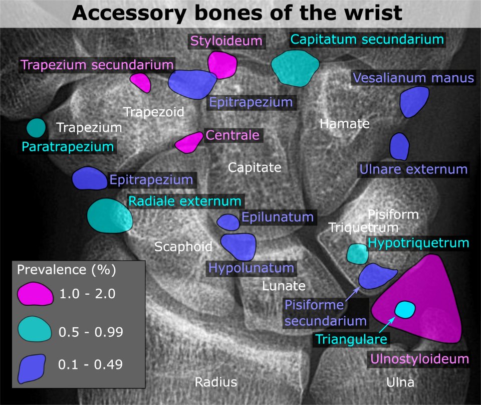 Accessory bones of the wrist photo