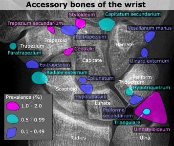 Accessory bones of the wrist photo