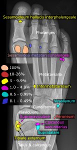 Accessory and sesamoid bones of the foot - dorsoplantar projection - la photo