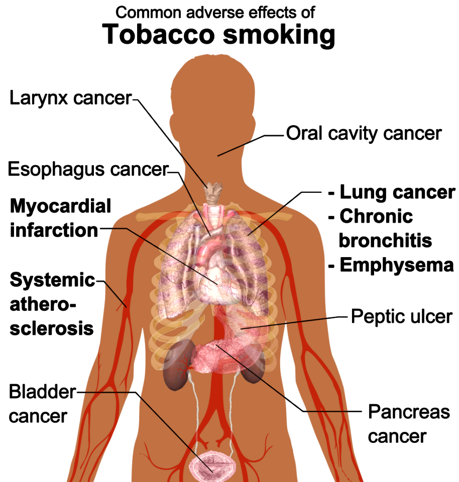 Adverse effects of tobacco smoking