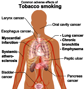 Adverse effects of tobacco smoking