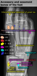 Accessory and sesamoid bones of the foot - dorsoplantar projection