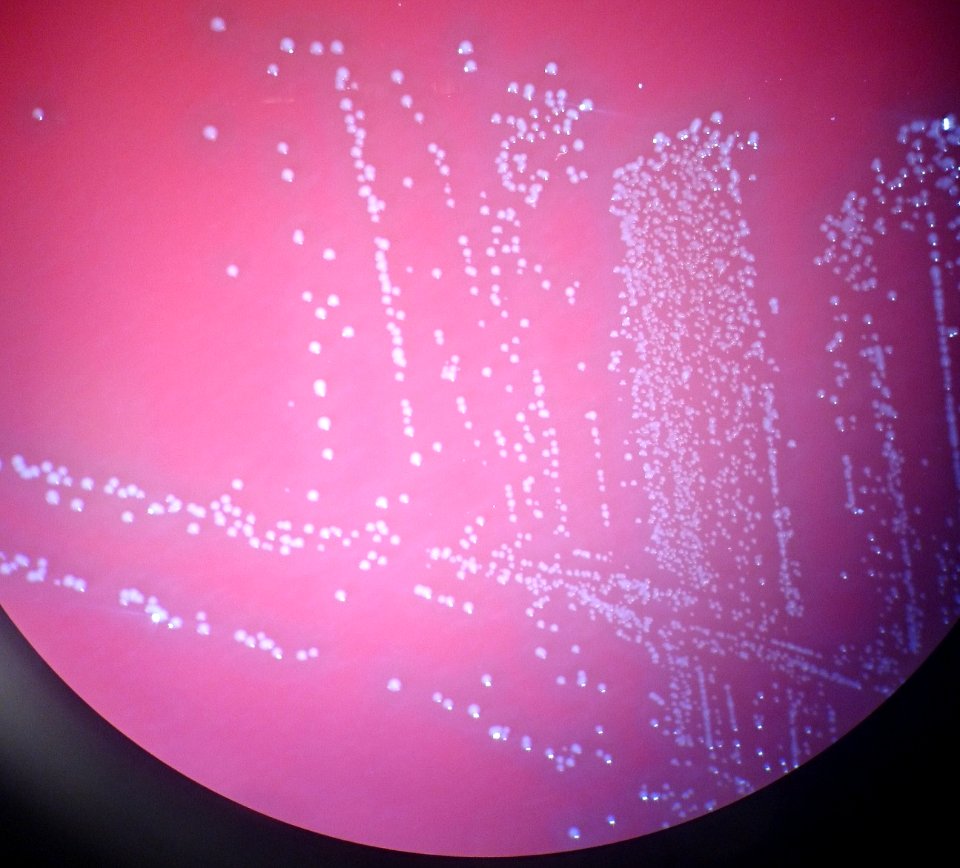 Aerococcus urinae - colonies