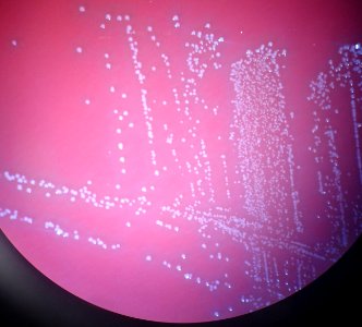 Aerococcus urinae - colonies photo