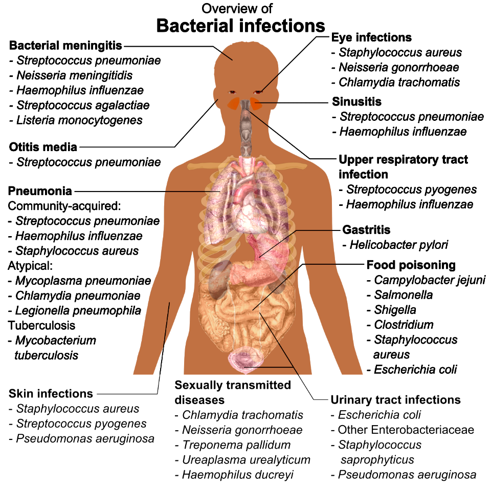 Bacterial infections and involved species photo