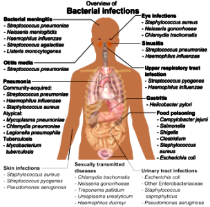 Bacterial infections and involved species