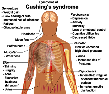 Cushing's syndrome photo