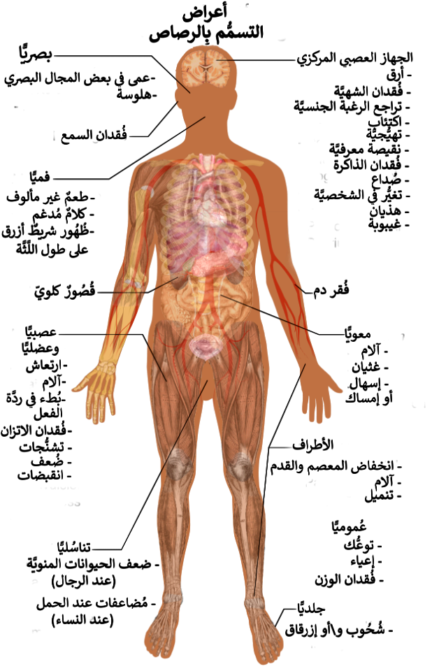 Symptoms of lead poisoning (raster)-ar
