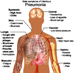 Main symptoms of infectious pneumonia