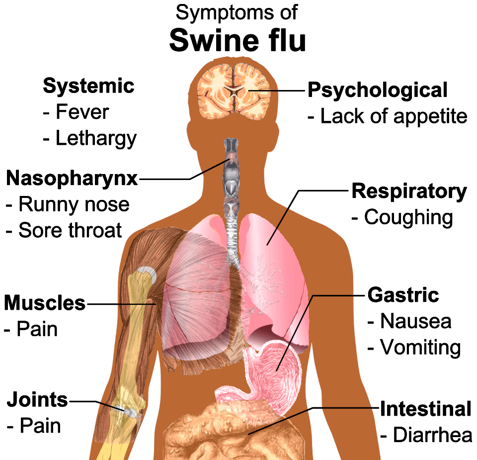Symptoms of swine flu
