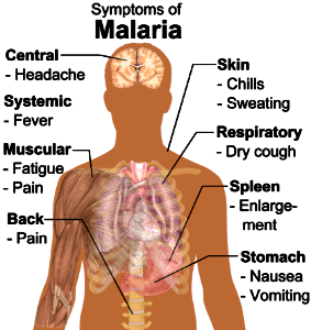 Symptoms of Malaria photo