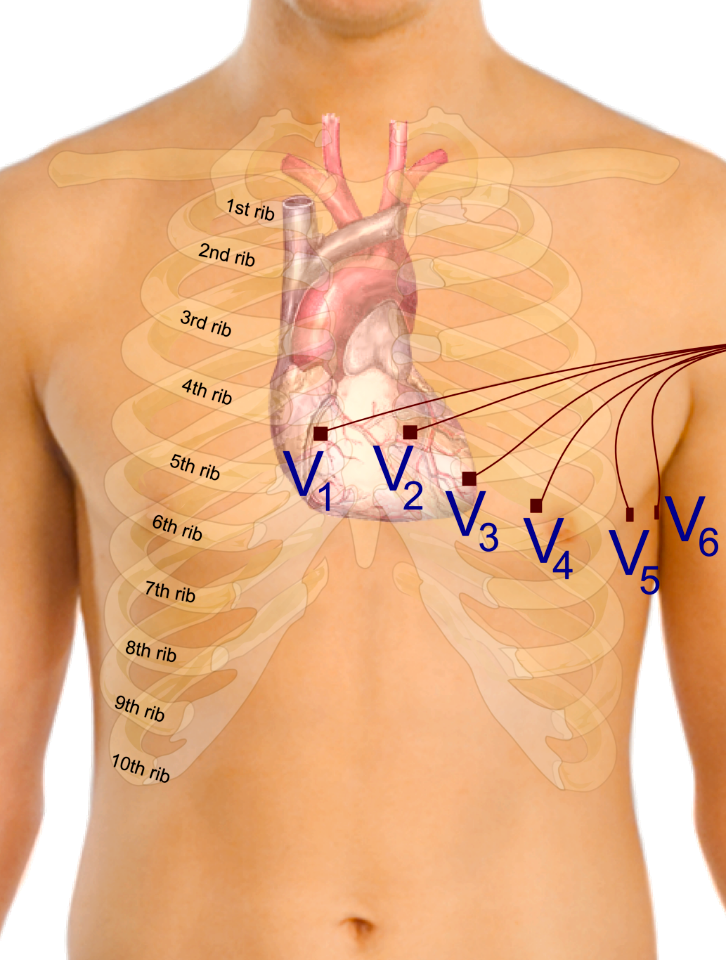 Precordial leads in ECG