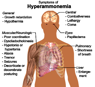 Symptoms of hyperammonemia photo