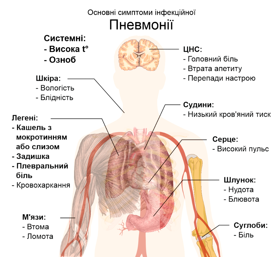 Symptoms of pneumonia ua