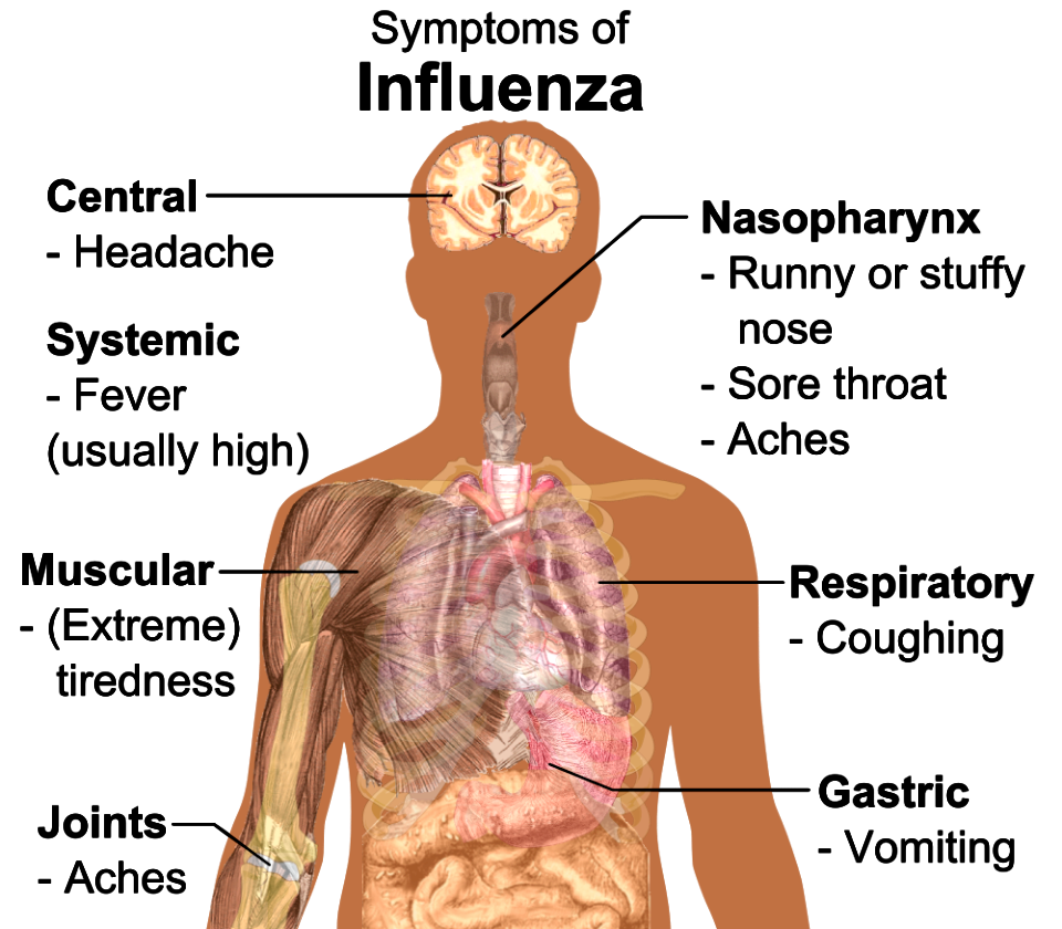 Symptoms of influenza