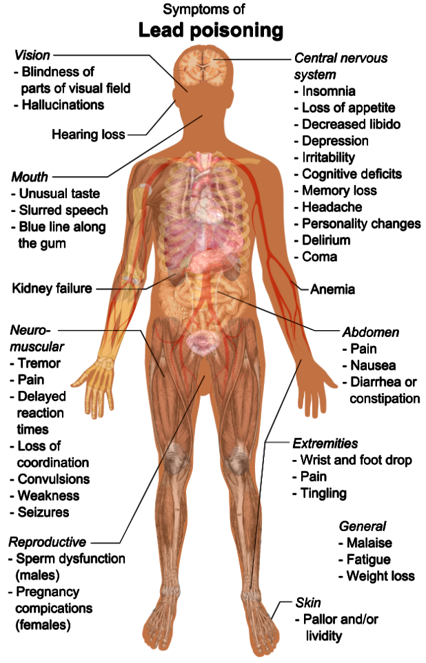 Symptoms of lead poisoning (raster)