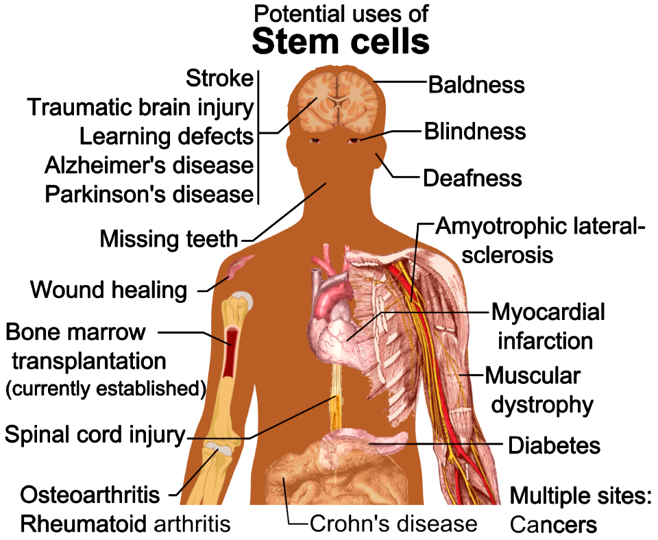 Stem cell treatments