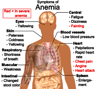 Symptoms of anemia photo