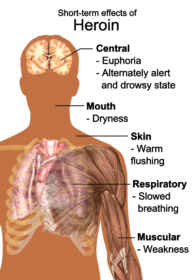 Short-term effects of heroin