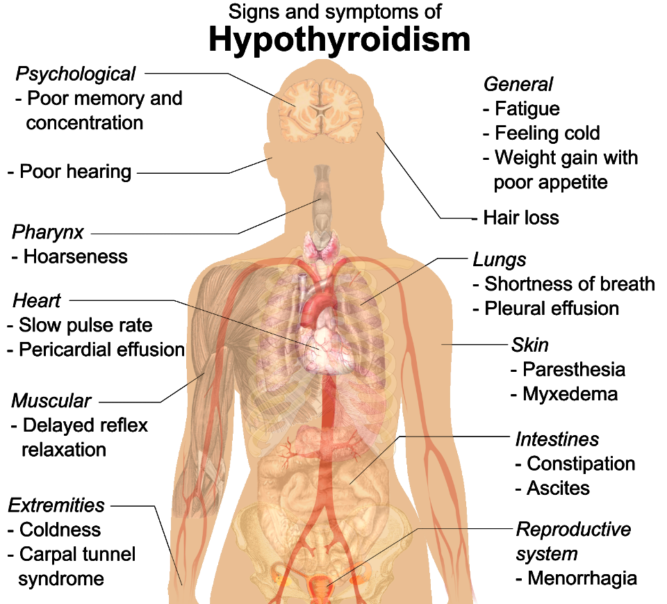 Signs and symptoms of hypothyroidism