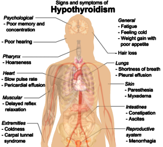 Signs and symptoms of hypothyroidism
