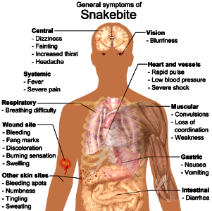 Snake bite symptoms photo