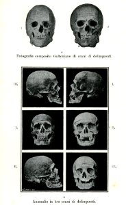 "Anomalie in tre crani di delinquenti" photo