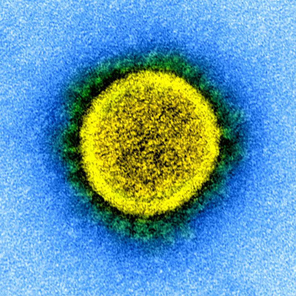 Novel Coronavirus SARS-CoV-2 (49666786197) (cropped)