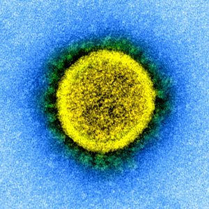 Novel Coronavirus SARS-CoV-2 (49666786197) (cropped) photo