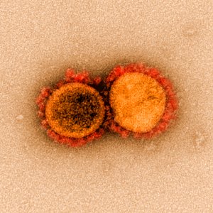 Novel Coronavirus SARS-CoV-2 (49666507616) photo