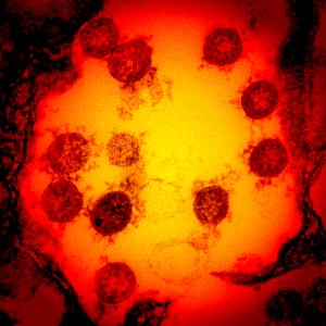 Novel Coronavirus SARS-CoV-2 (49919836457) photo