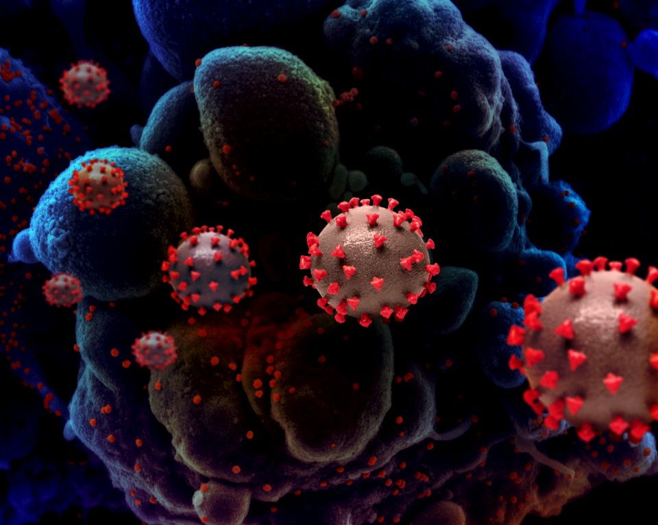 Novel Coronavirus SARS-CoV-2 (50047466123)