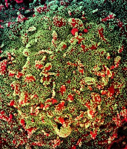 Novel Coronavirus SARS-CoV-2 (50798069226) photo
