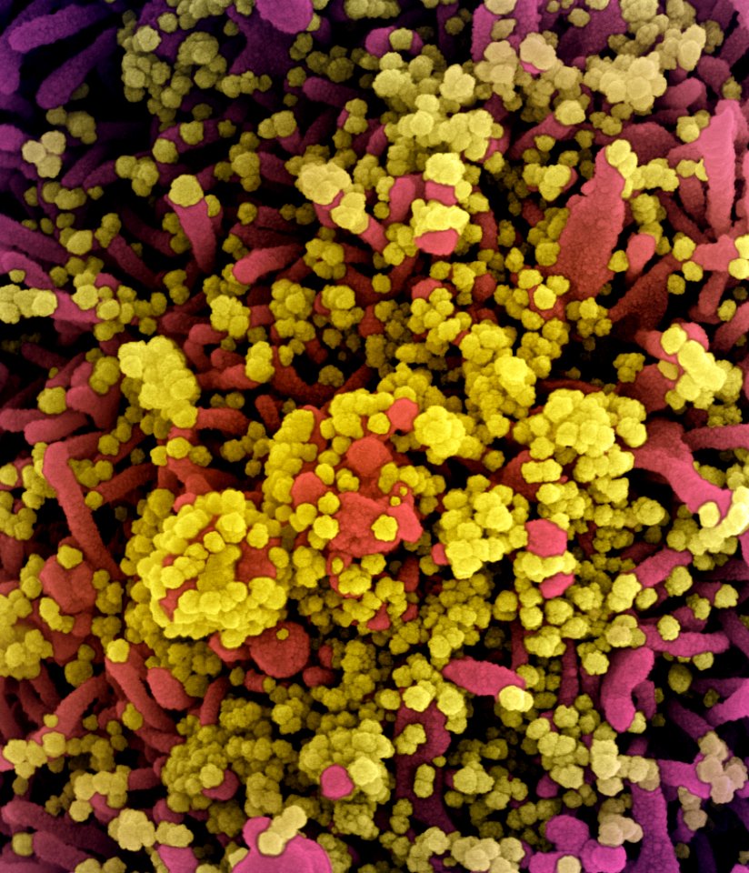 Novel Coronavirus SARS-CoV-2 (50098152516)