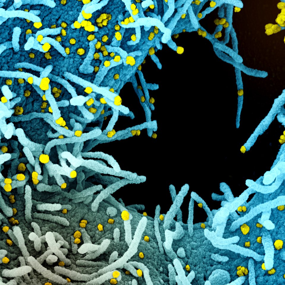 Novel Coronavirus SARS-CoV-2 (50098153461)